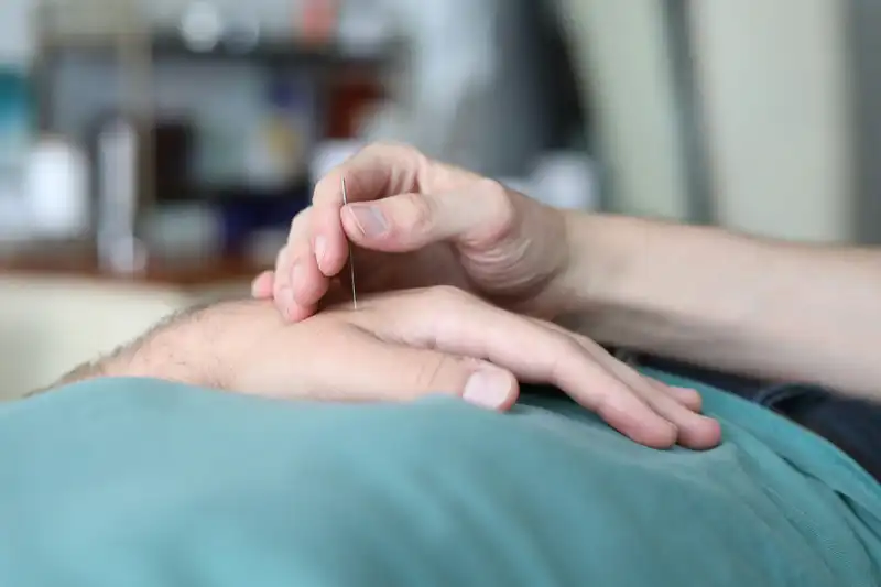 acupuncture needle treatment
